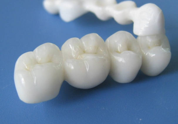 第Ⅱ類(lèi)醫(yī)療器械“定制式義齒”產(chǎn)品的注冊(cè)申報(bào)資料要求及審評(píng)共性問(wèn)題分享(圖1)