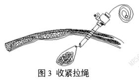 一次性使用內窺鏡用活檢袋注冊審查指導原則（2025年第20號）(圖3)
