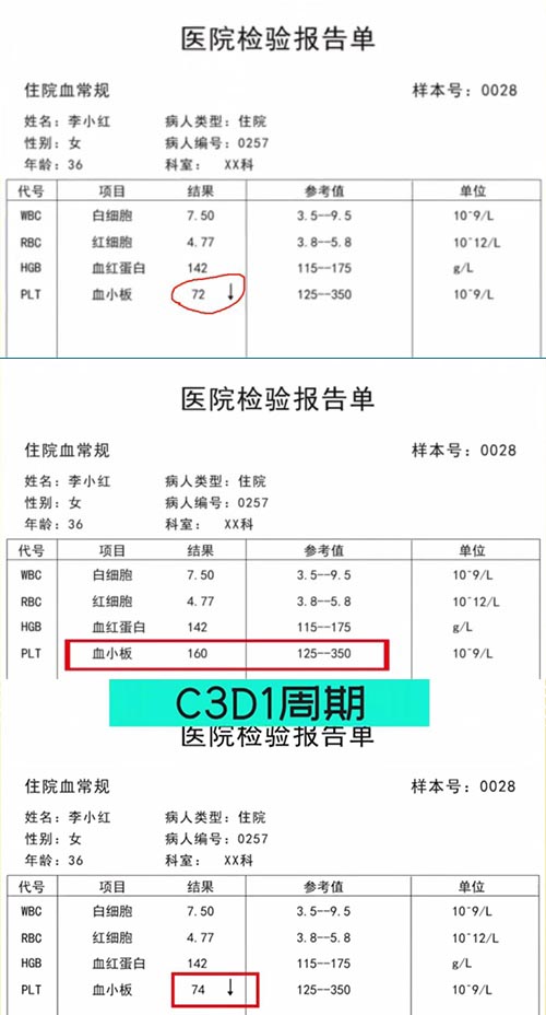 AE與研究藥物關(guān)系記錄不一致，如何處理？